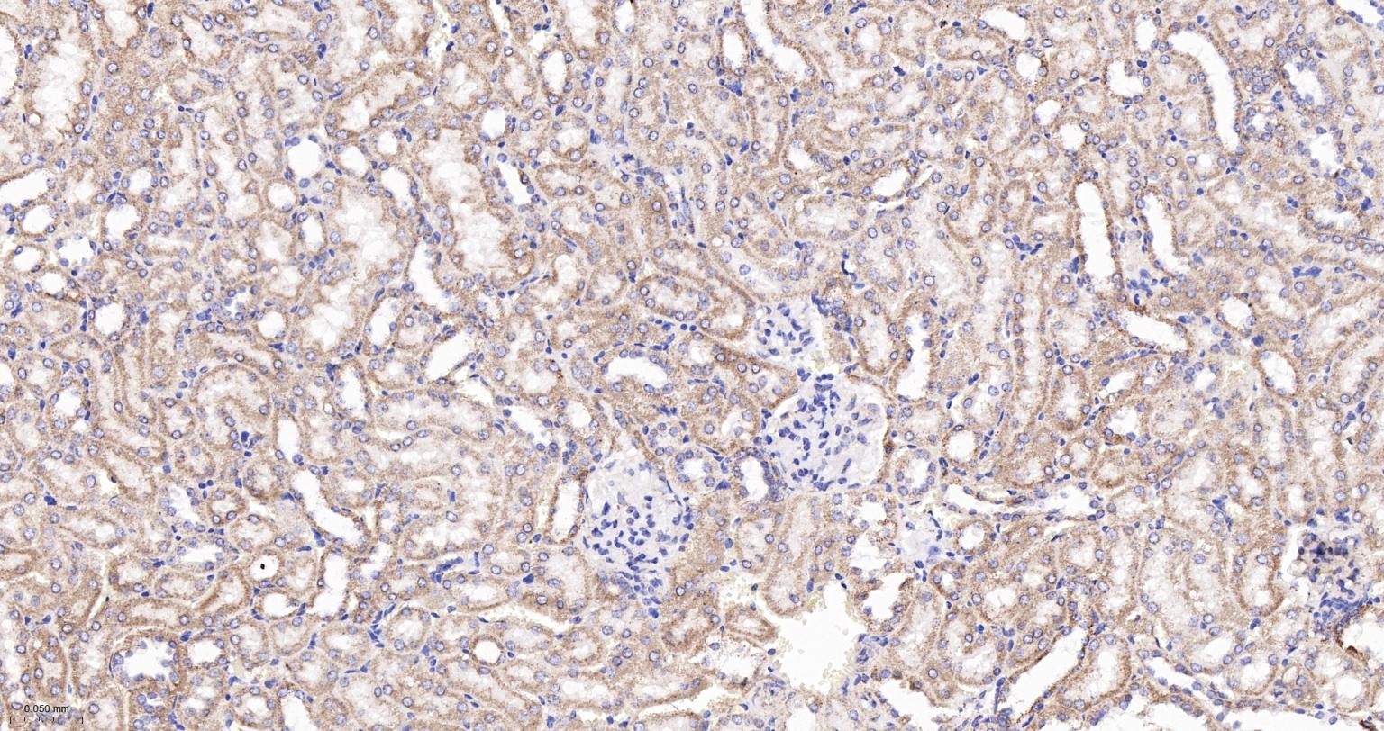 ATP合成酶β5重组兔单克隆抗体
