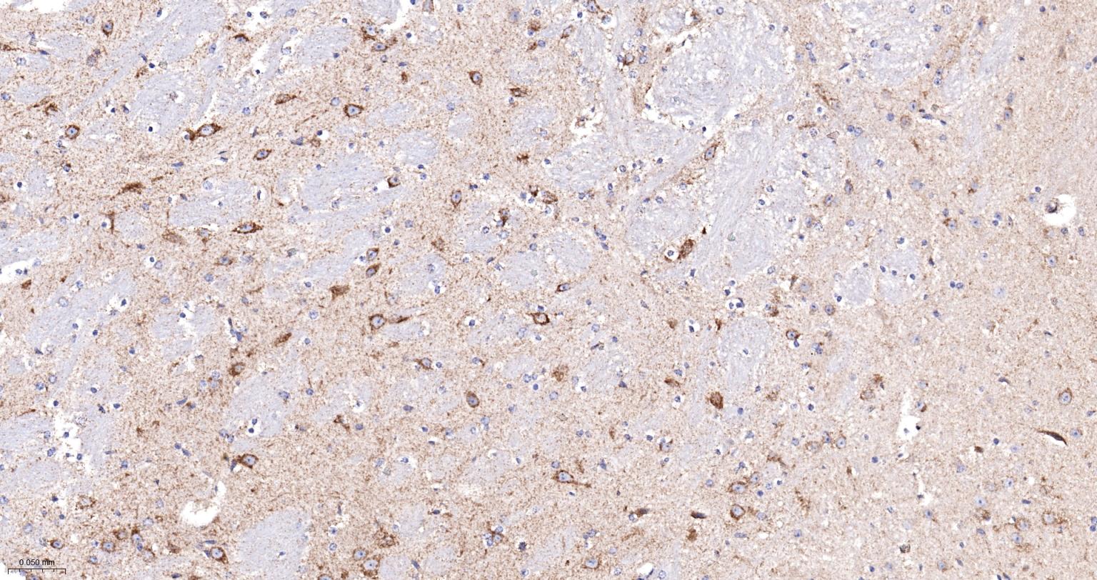 细胞色素C重组兔单抗