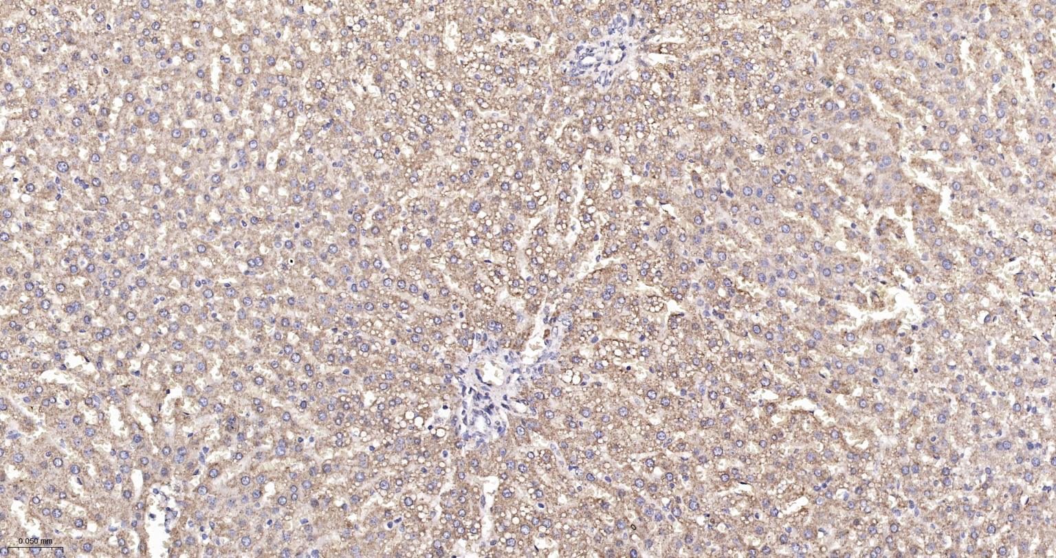 ATP合成酶β5重组兔单克隆抗体