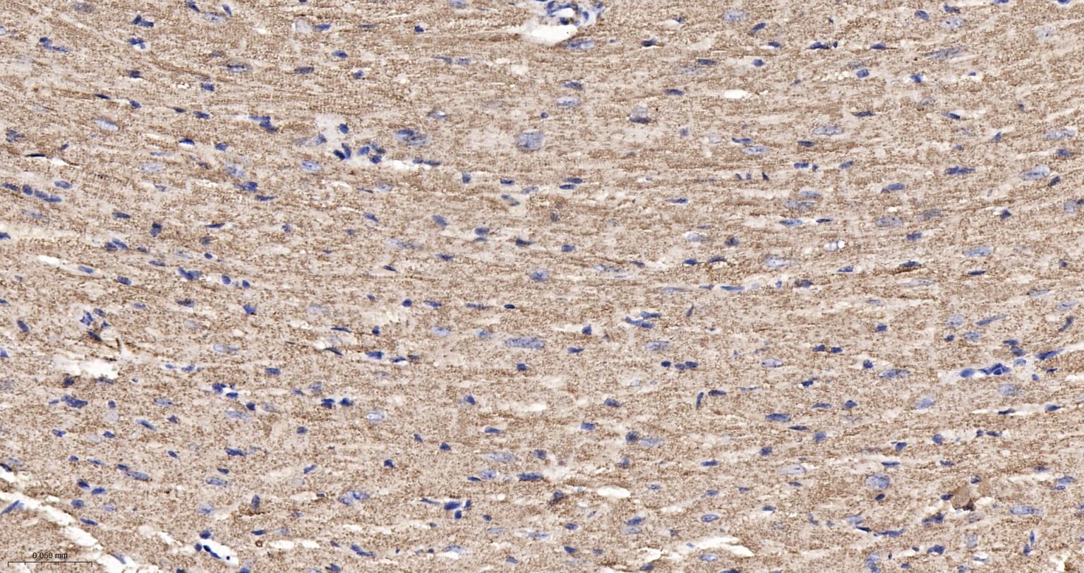 ATP合成酶β5重组兔单克隆抗体