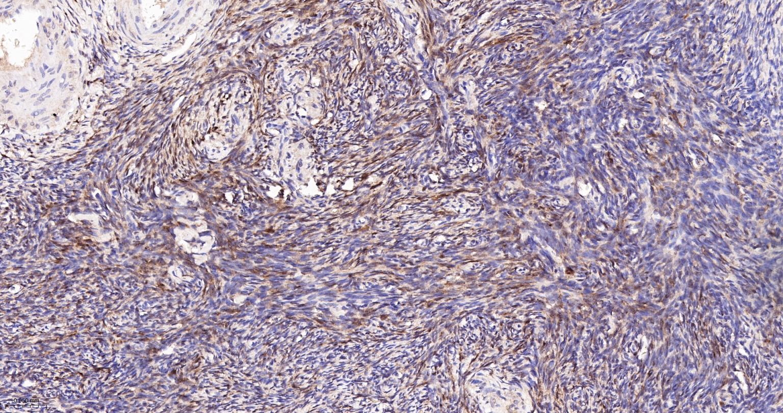 半乳糖凝集素3重组兔单抗