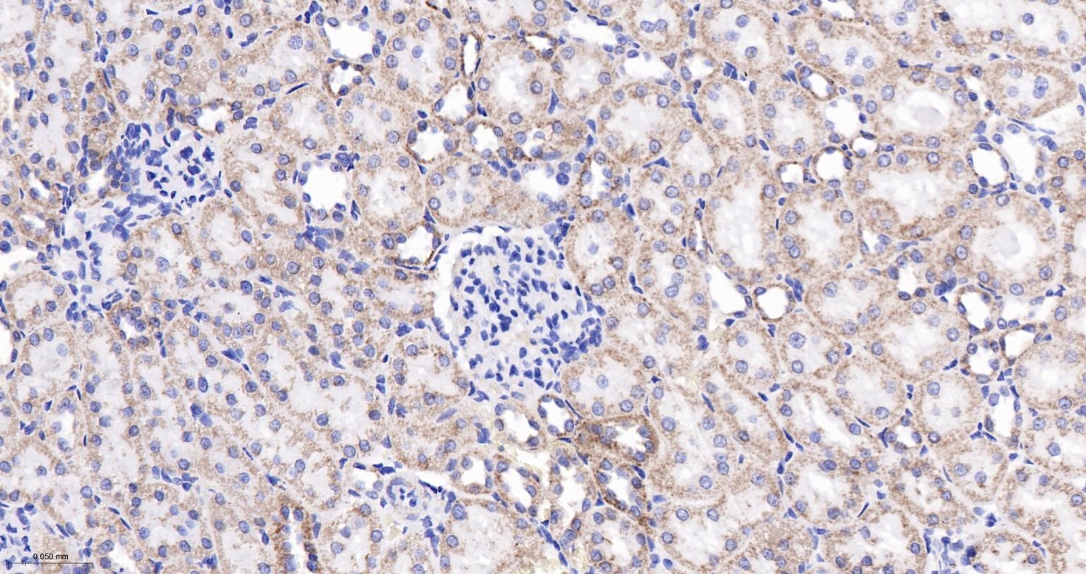 ATP合成酶β5重组兔单克隆抗体