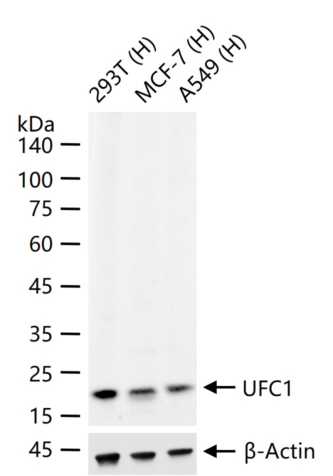UFC1 Recombinant Rabbit mAb (一抗) - WB,IHC-P,IHC-F,IF,ICC/IF,IP | Bioss