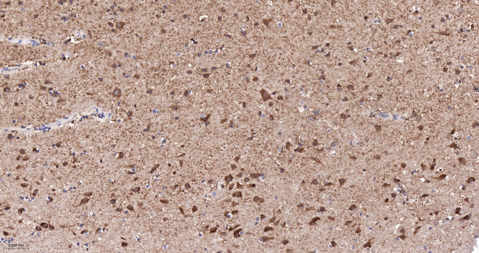 细胞色素C重组兔单抗