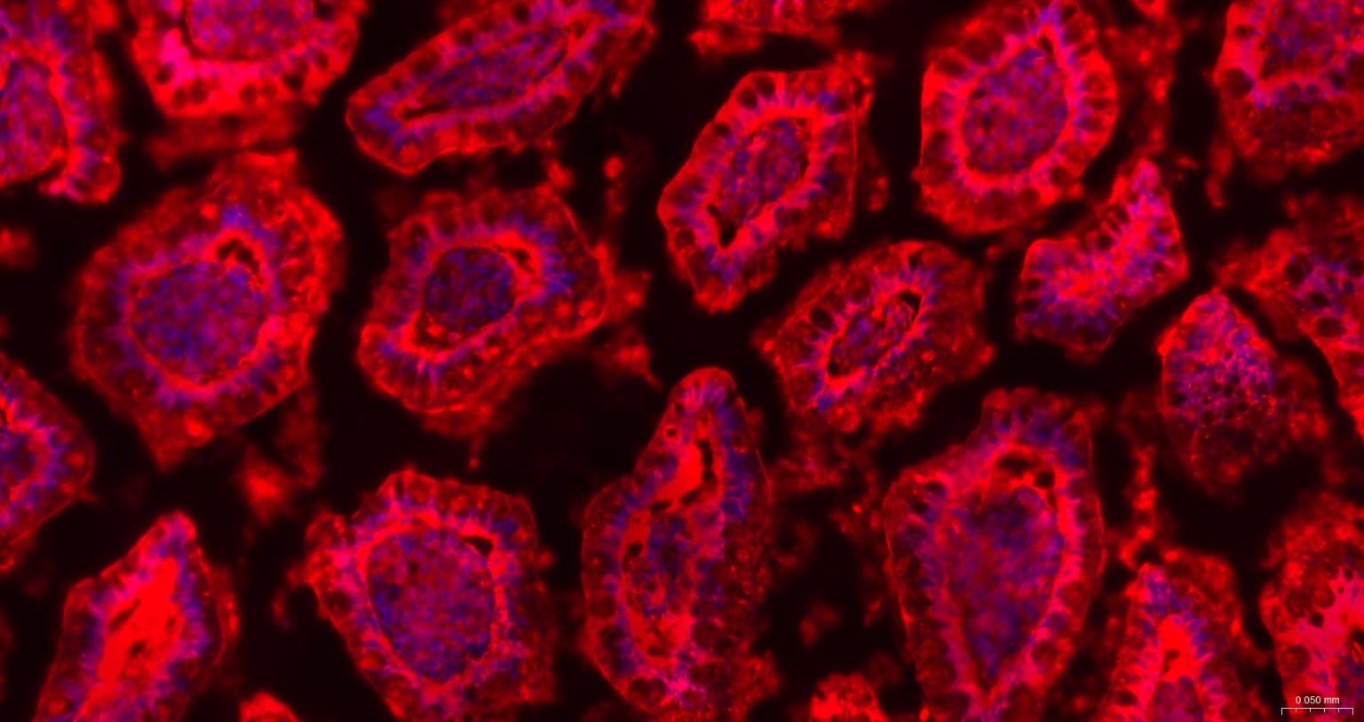 半乳糖凝集素3重组兔单抗
