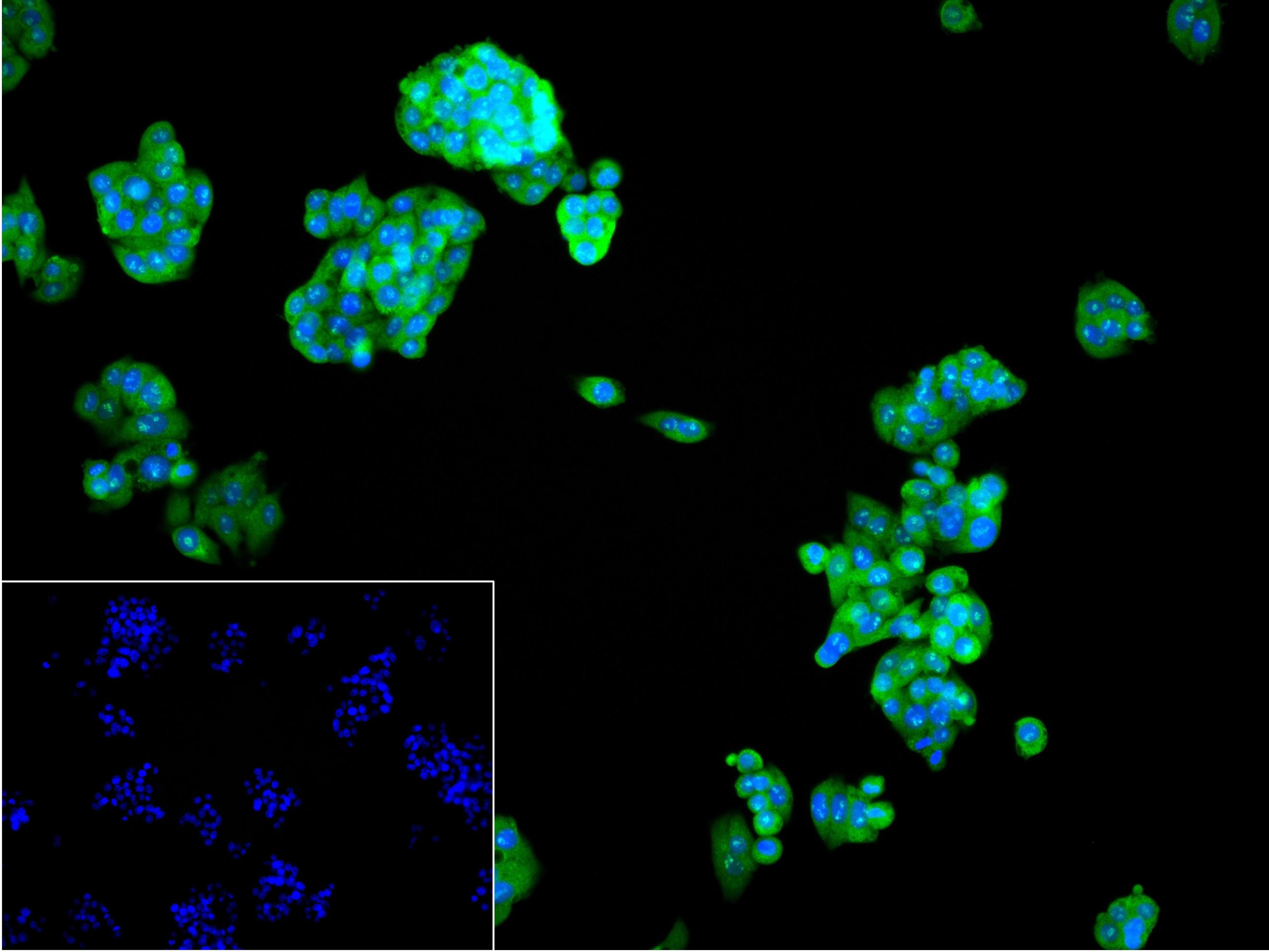 细胞内氯离子通道蛋白4重组兔单抗