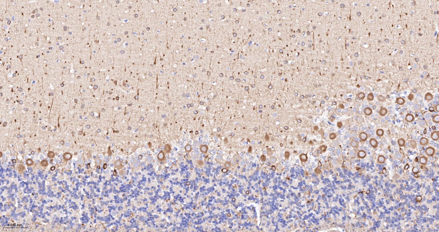 微管蛋白β3（神经标志物）单克隆抗体-bsm-33177M