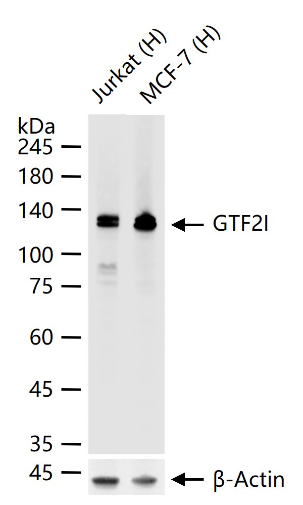 蛋白酪氨酸激酶BAP135重组兔单抗