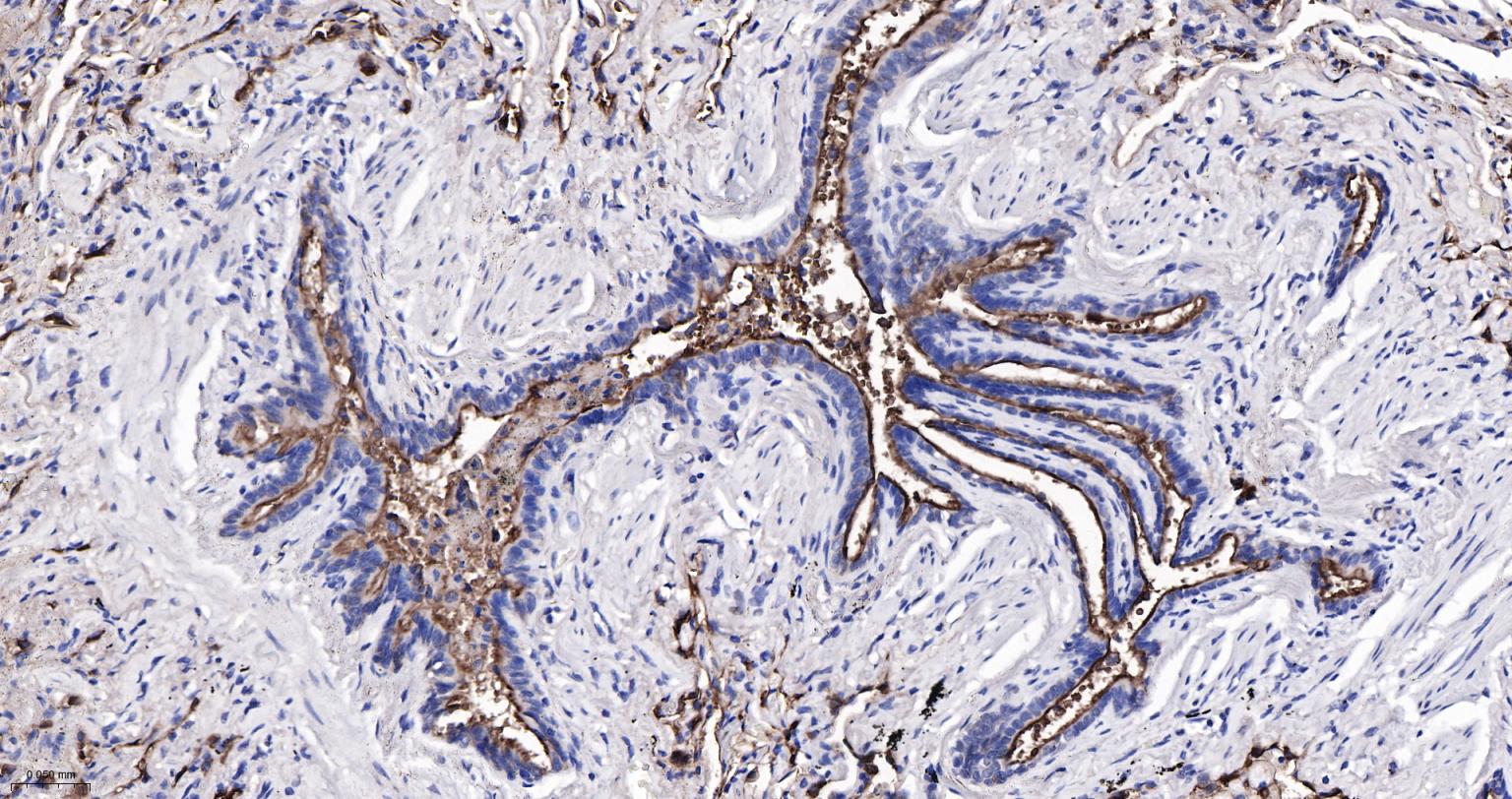 粘蛋白-1重组兔单抗