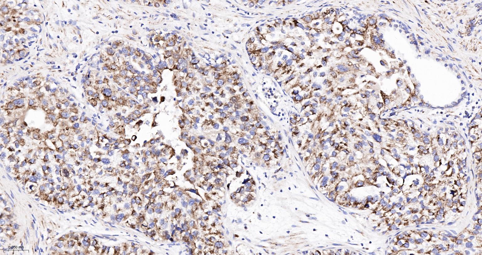 细胞色素C重组兔单抗