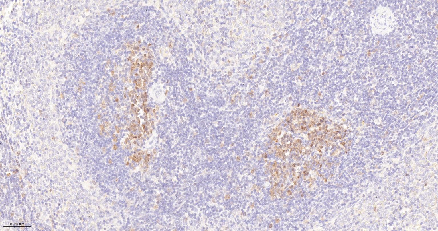 细胞凋亡抑制因子重组兔单抗