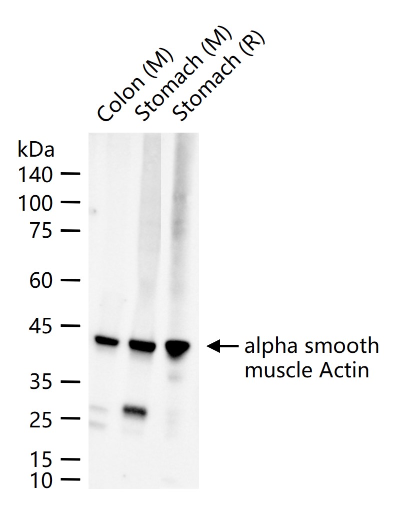 肌动蛋白α/α-SMA/α Actin重组兔单抗