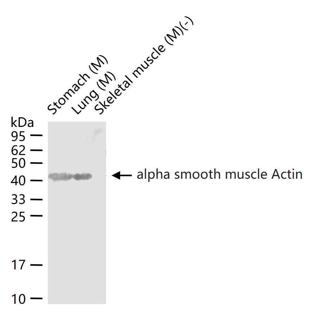 肌动蛋白α/α-SMA/α Actin抗体-bs-0189R