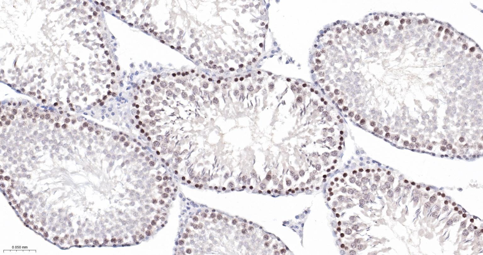 细胞凋亡抑制因子重组兔单抗