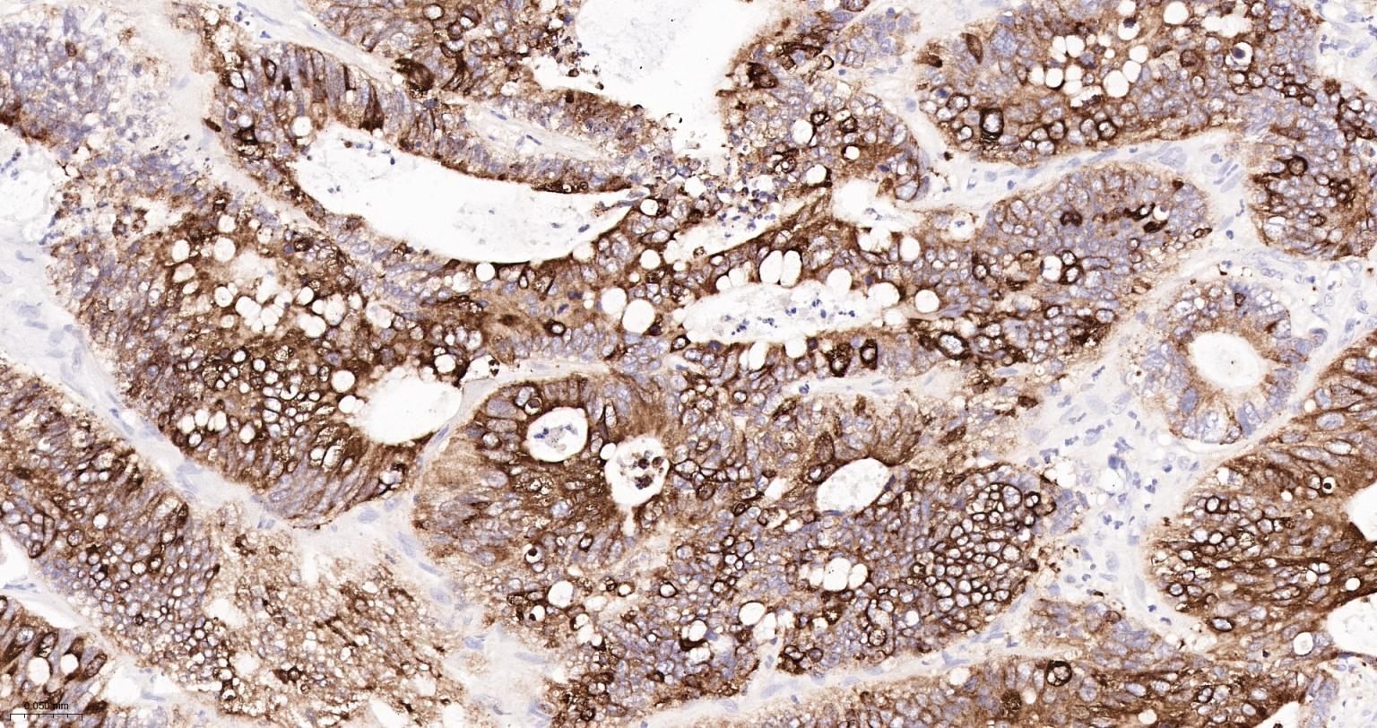 环氧合酶2重组兔单抗