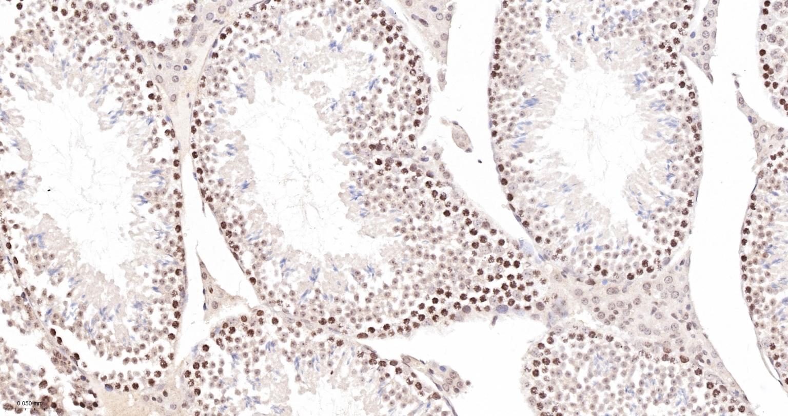细胞凋亡抑制因子重组兔单抗
