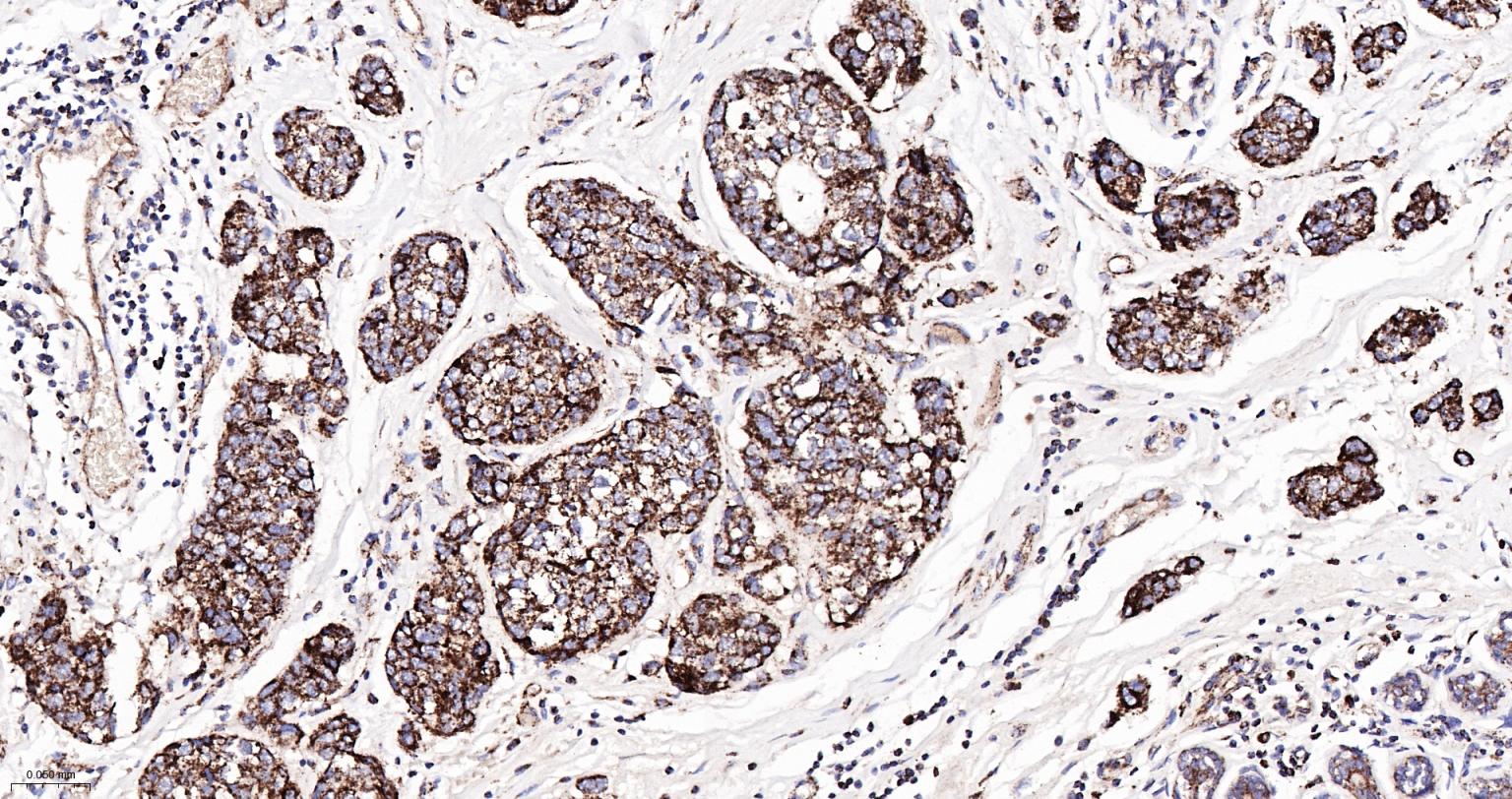 细胞色素C重组兔单抗