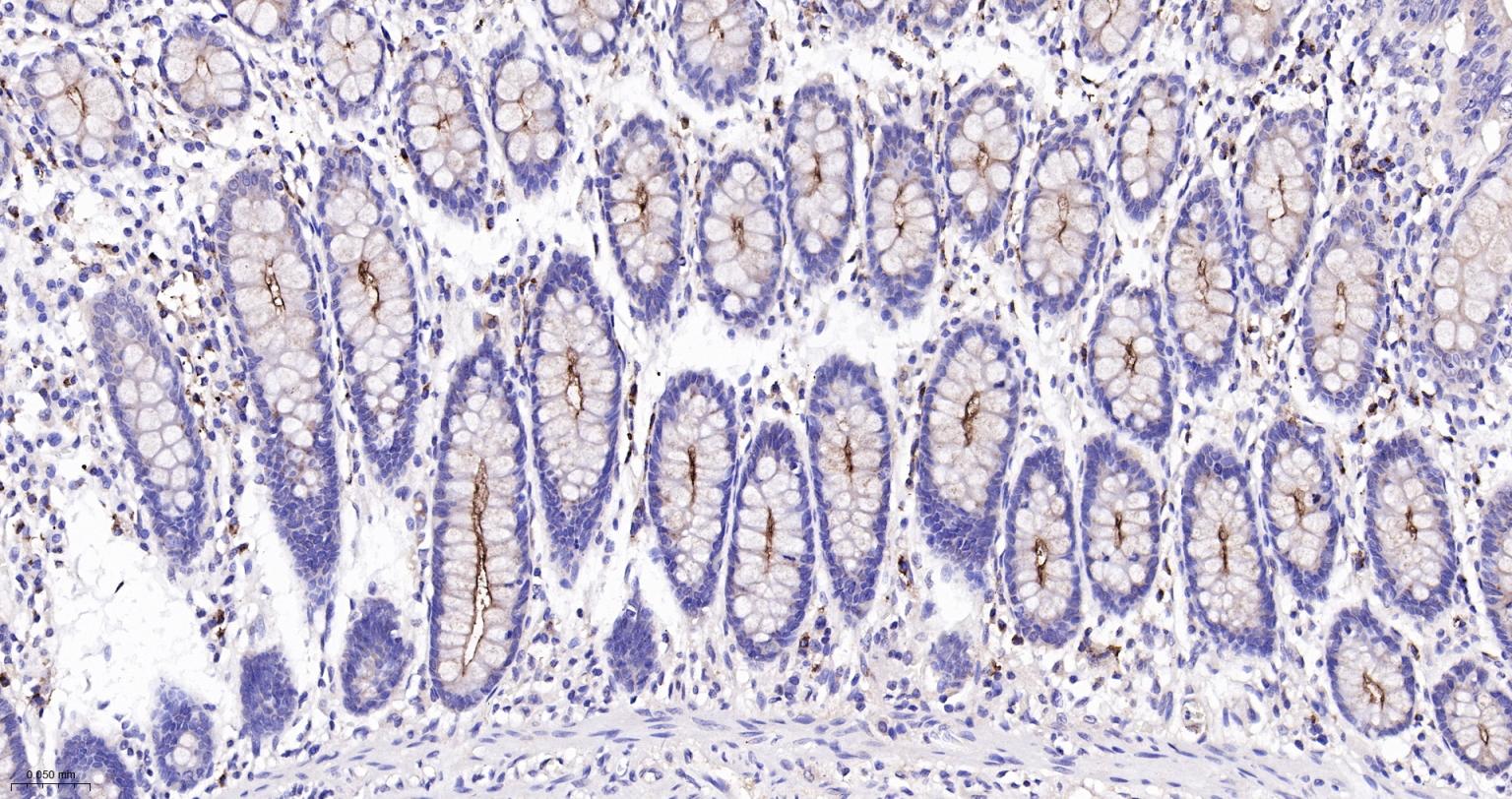 粘蛋白-1重组兔单抗