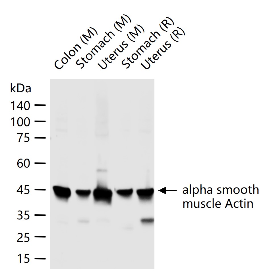 α-SMA重组兔单抗