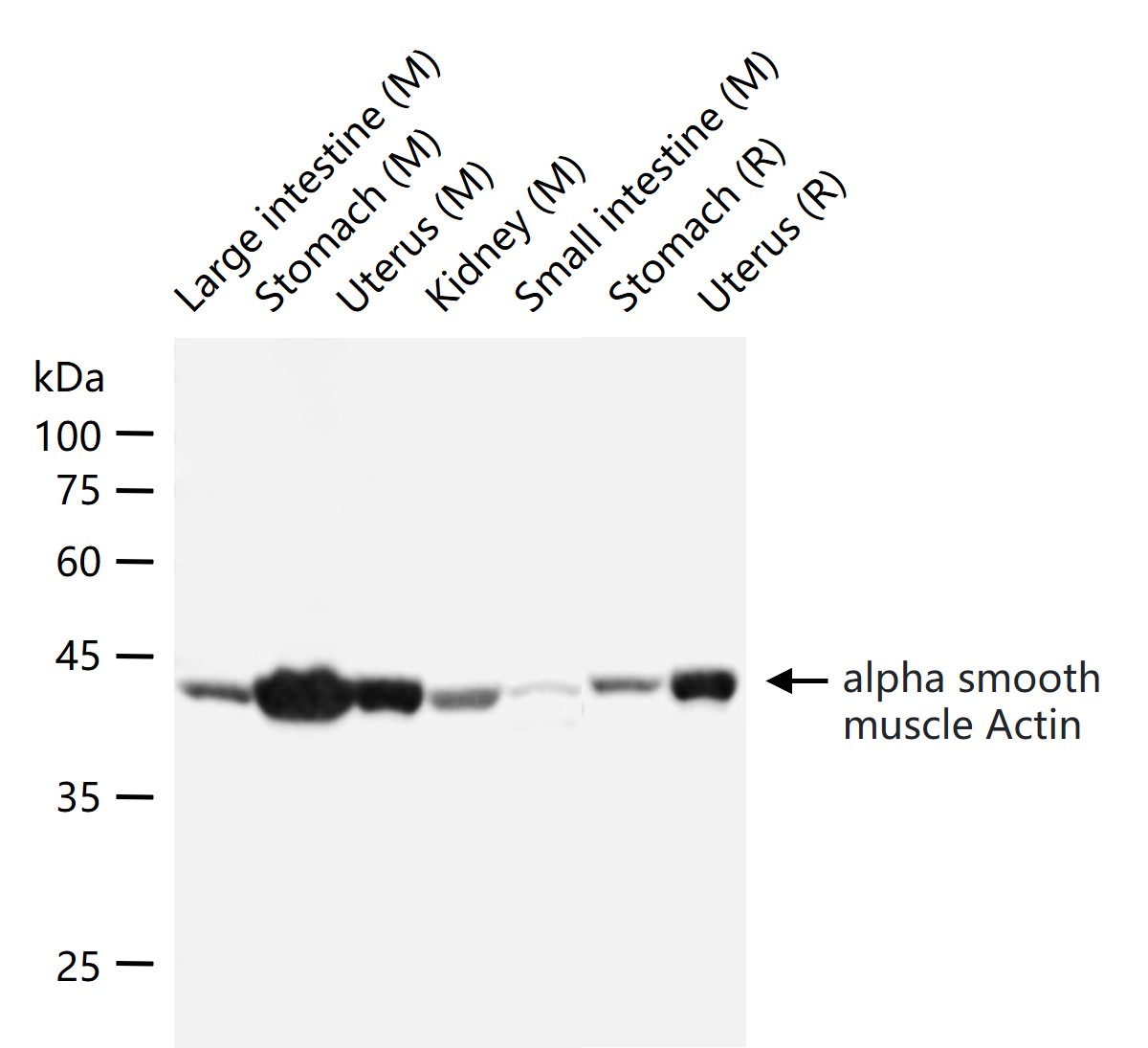 α-SMA重组兔单抗