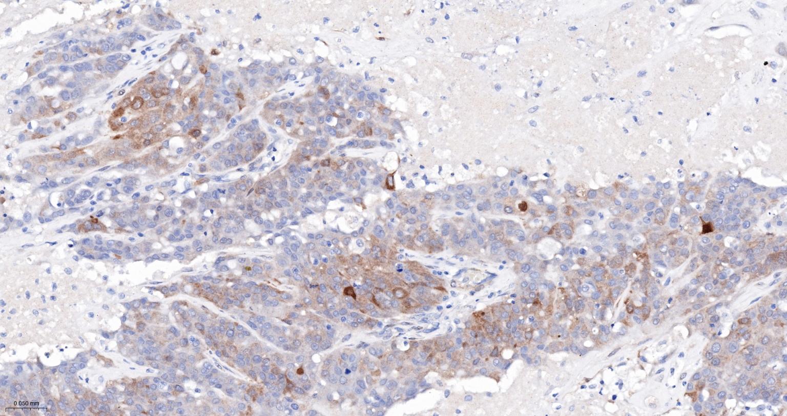 热休克蛋白-20重组兔单抗