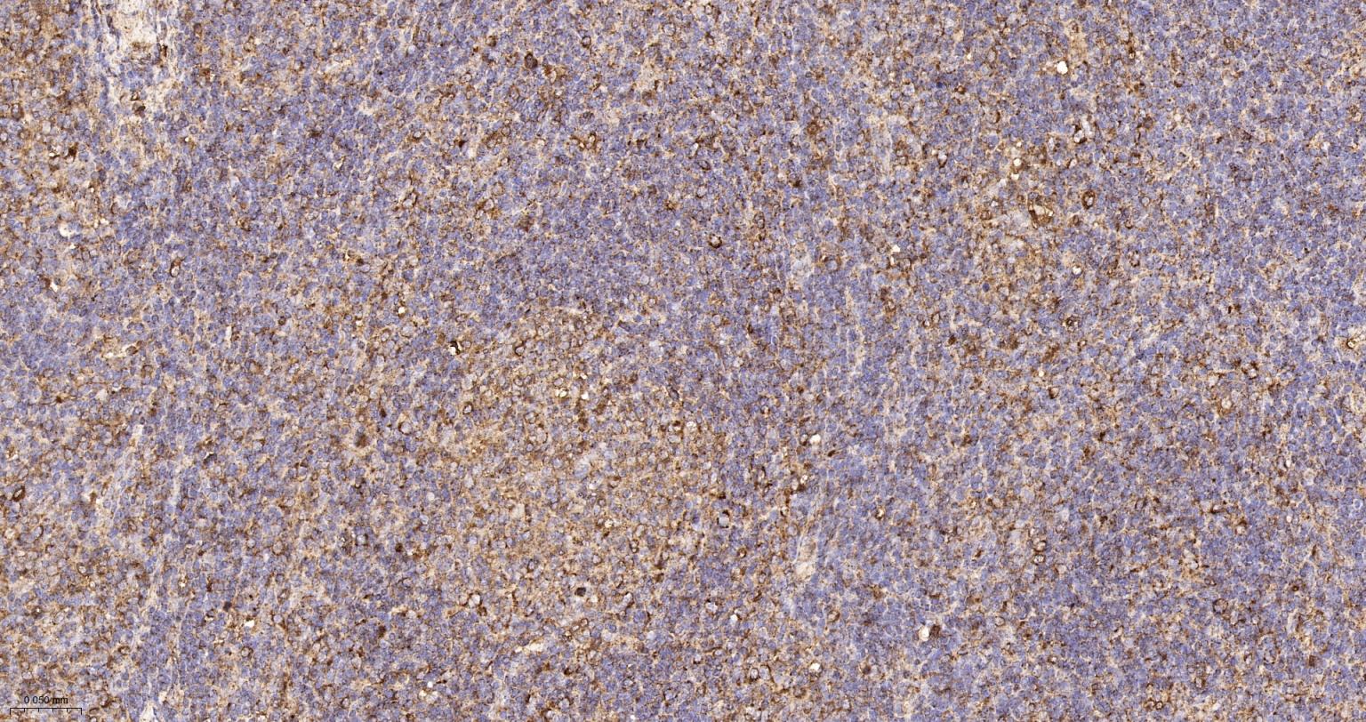 人IgM重组兔单抗