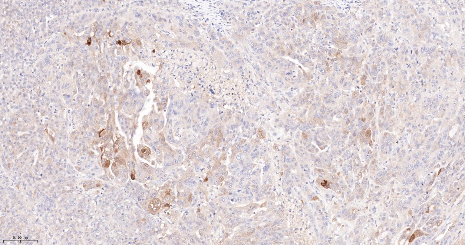 半乳糖凝集素3重组兔单抗