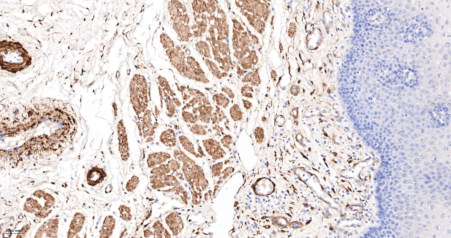 热休克蛋白-20重组兔单抗
