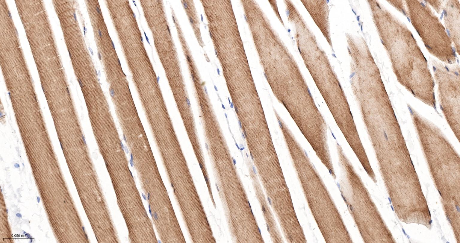 热休克蛋白-20重组兔单抗