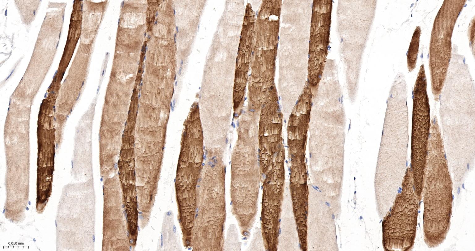 热休克蛋白-20重组兔单抗