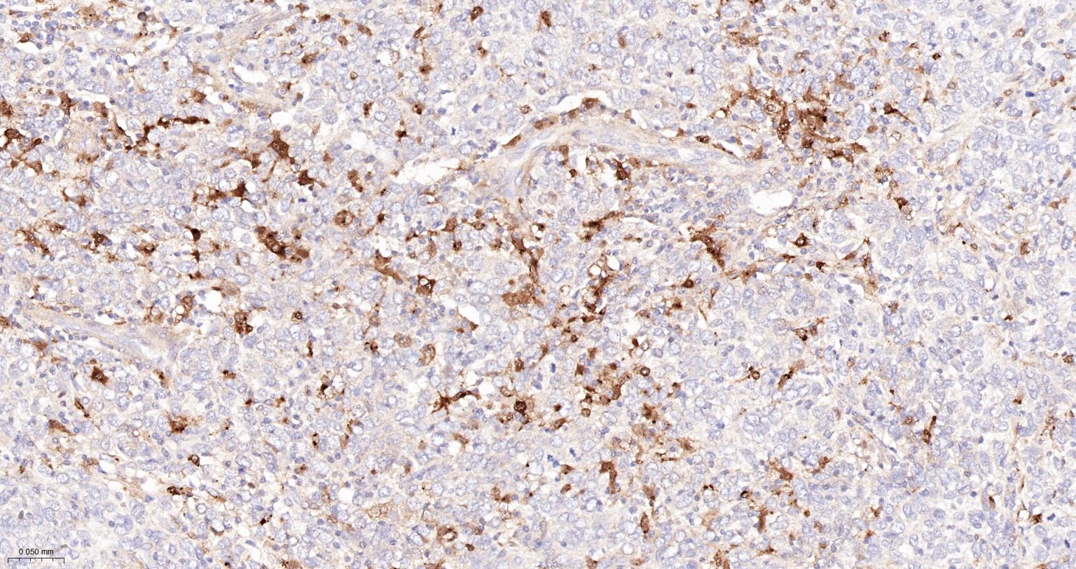 半乳糖凝集素3重组兔单抗