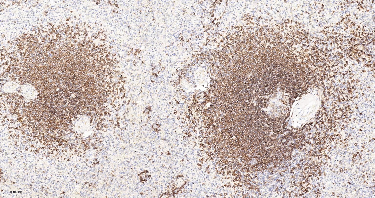 CD79A重组兔单克隆抗体