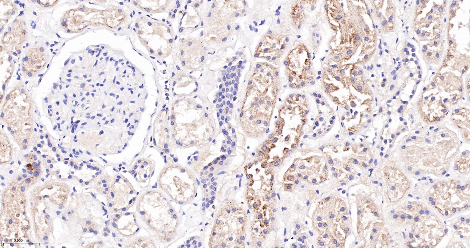 囊泡相关膜蛋白8重组兔单抗