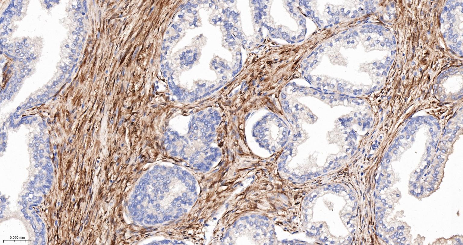热休克蛋白-20重组兔单抗