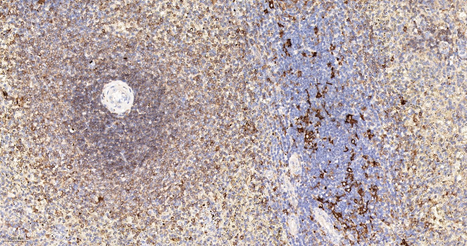 人IgM重组兔单抗