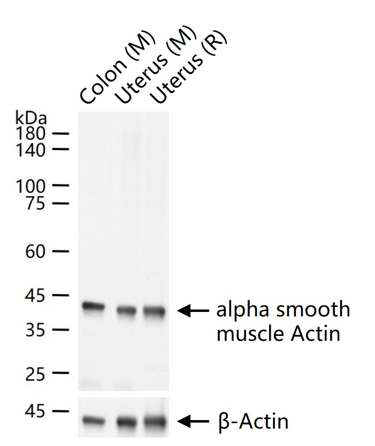 alpha smooth muscle Actin Mouse mAb (一抗) - WB,IHC-P,IHC-F,IF,Flow-Cyt,ICC/IF | Bioss
