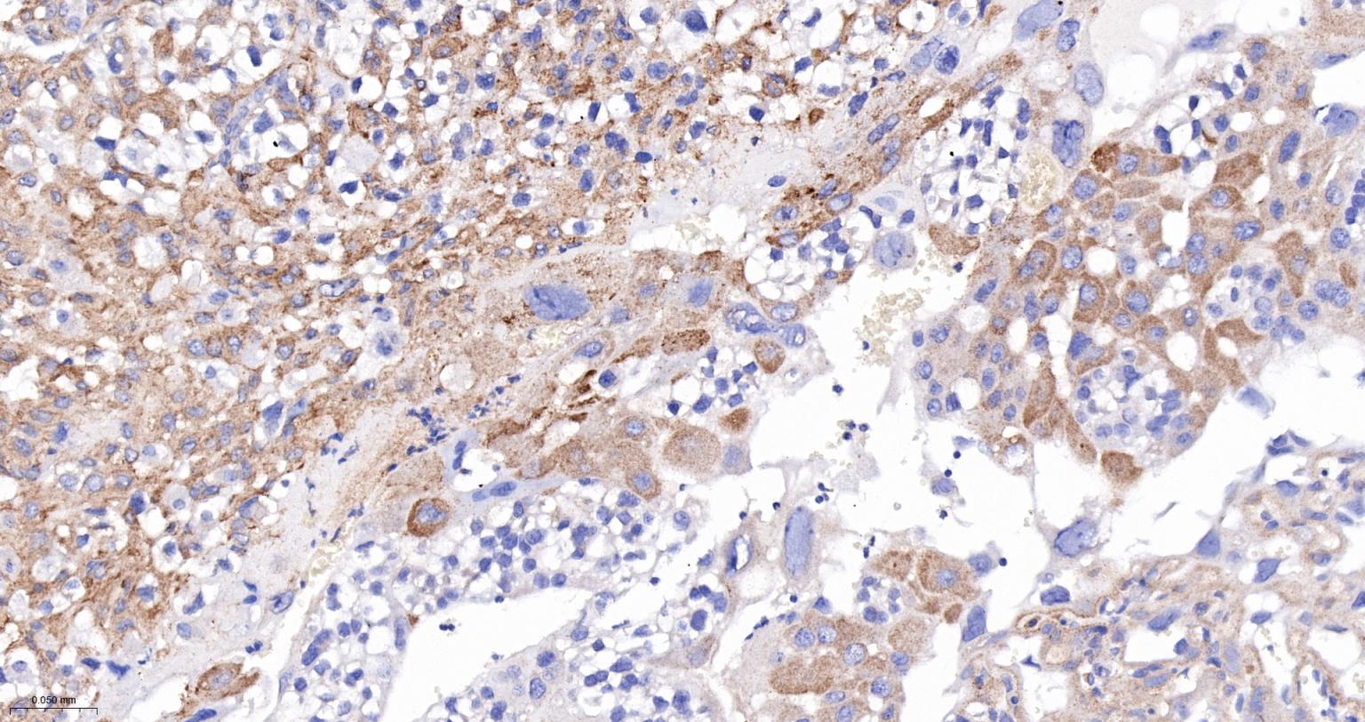 囊泡相关膜蛋白8重组兔单抗