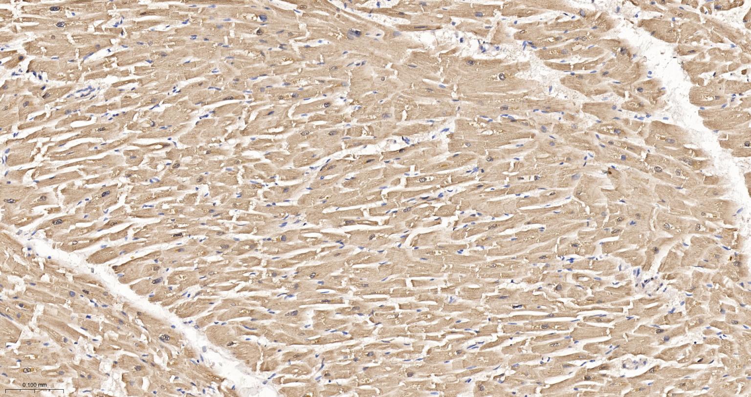 热休克蛋白-20重组兔单抗