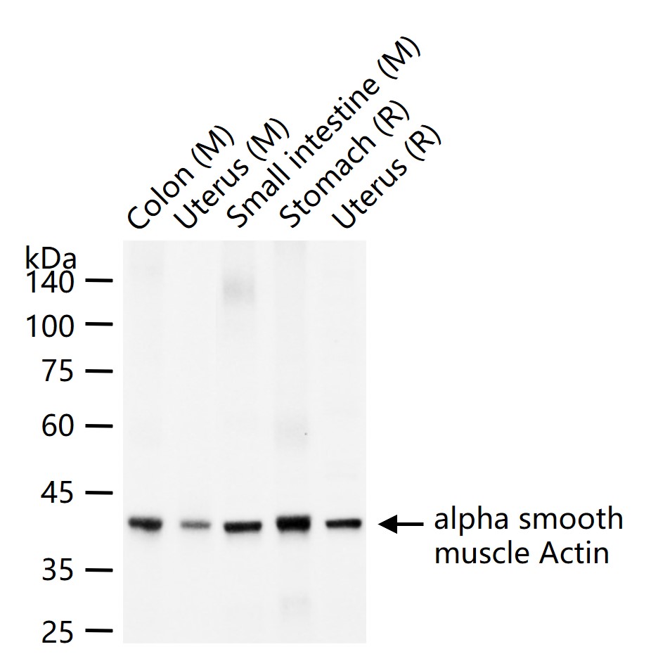 肌动蛋白α/α-SMA/α Actin抗体-bs-10196R