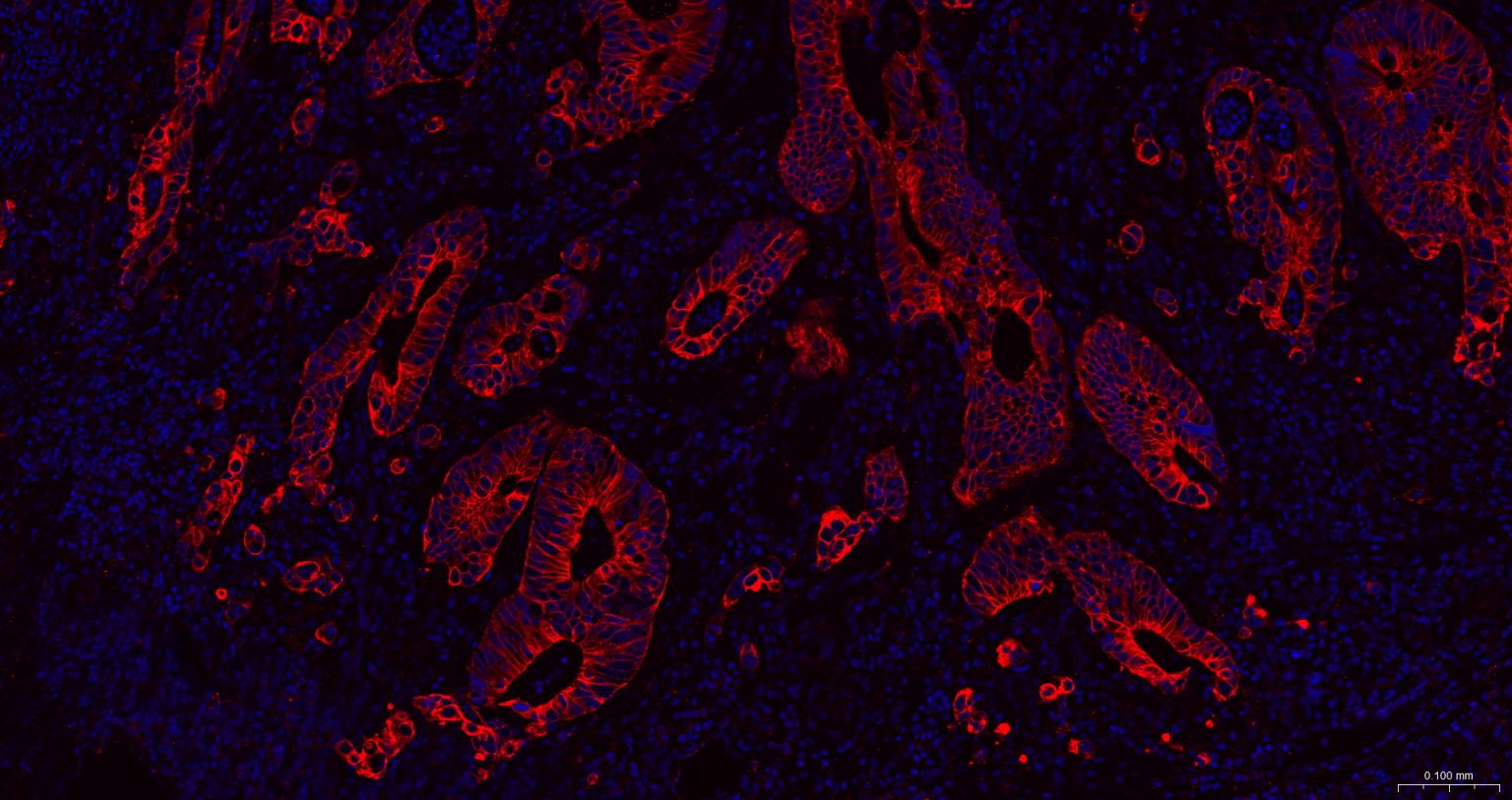细胞角蛋白18抗体(C端)-bs-1339R