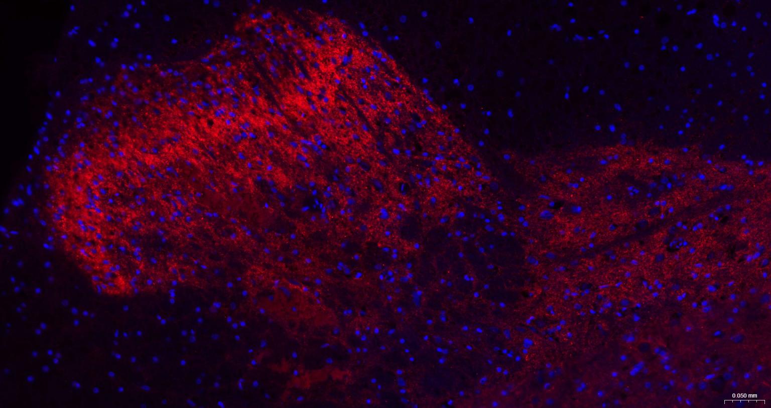γ氨基丁酸运载蛋白1重组兔单抗