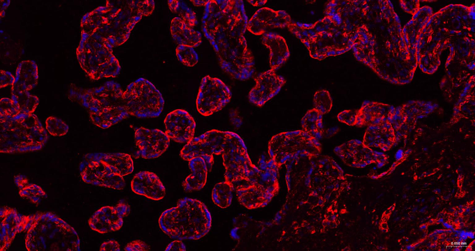 三磷酸腺苷结合转运蛋白G超家族成员2重组兔单抗