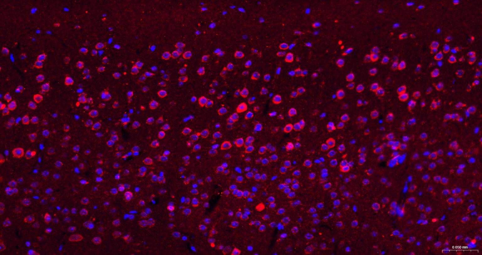 色氨酸羟化酶1重组兔单抗