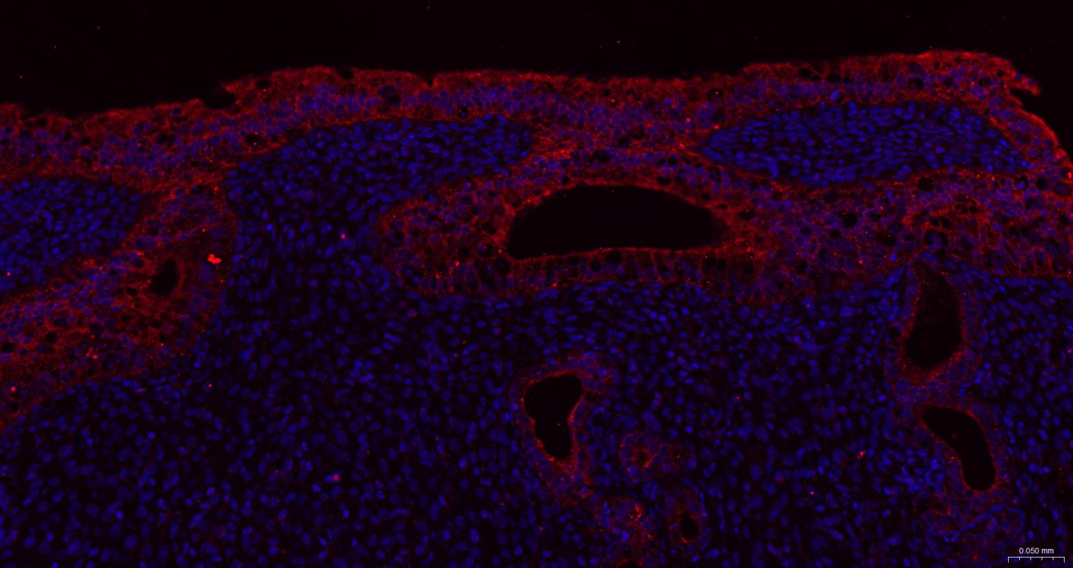 广谱细胞角蛋白PCK抗体