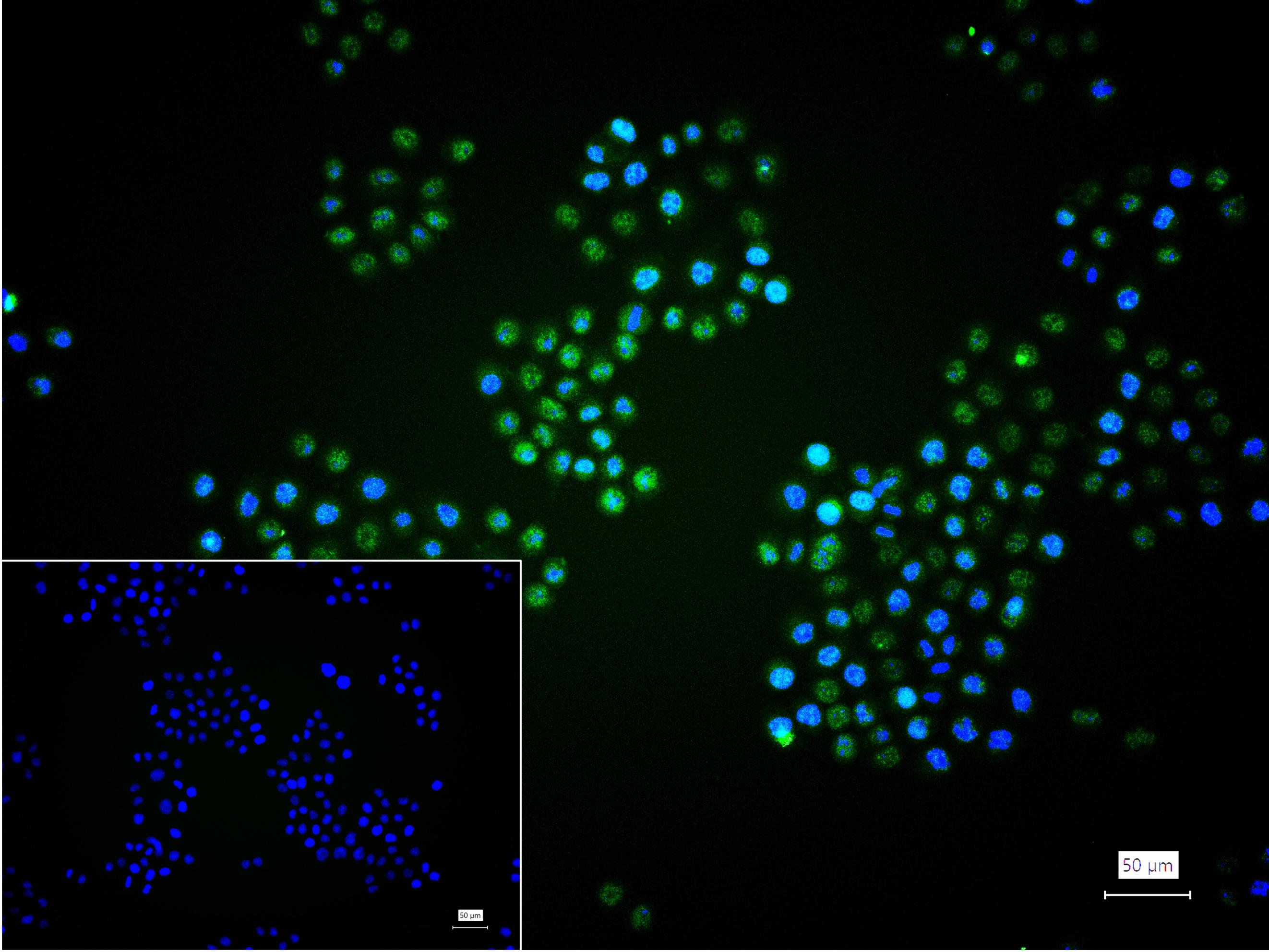 活化转录因子4重组兔单抗