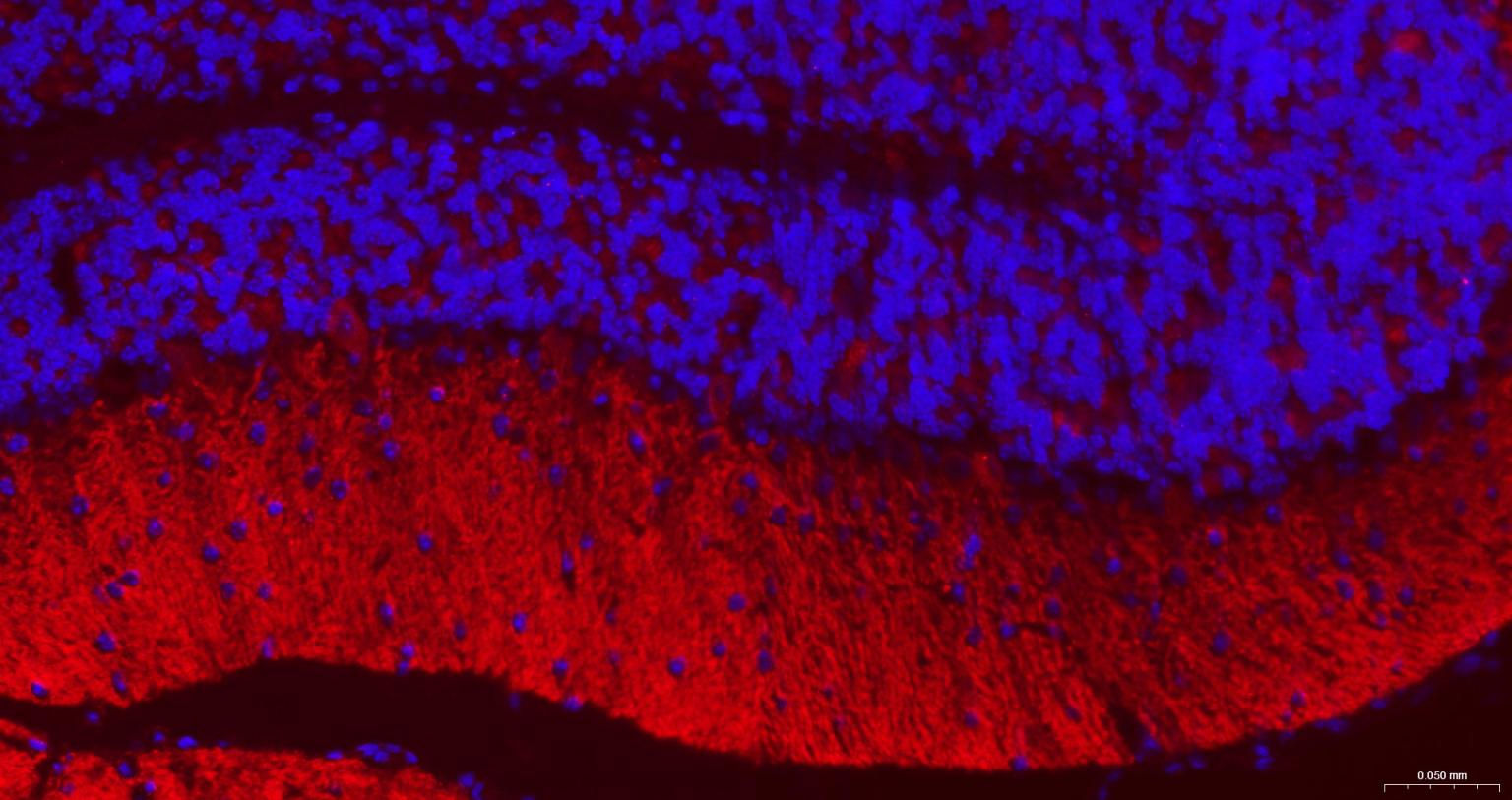 G氨基丁酸B型受体2重组兔单抗