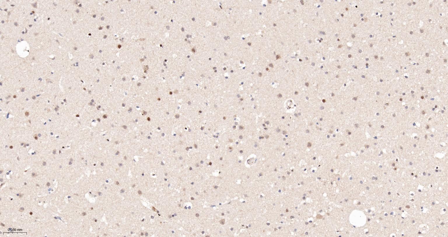 缺氧诱导因子1α抑制蛋白/HIF1AN重组兔单抗