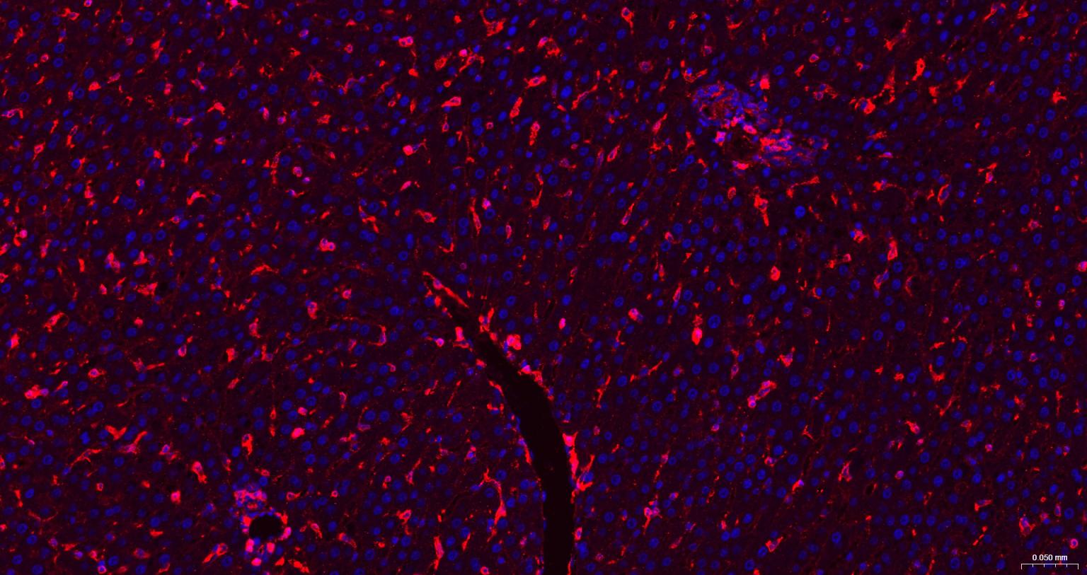 葡萄糖转运蛋白1重组兔单抗