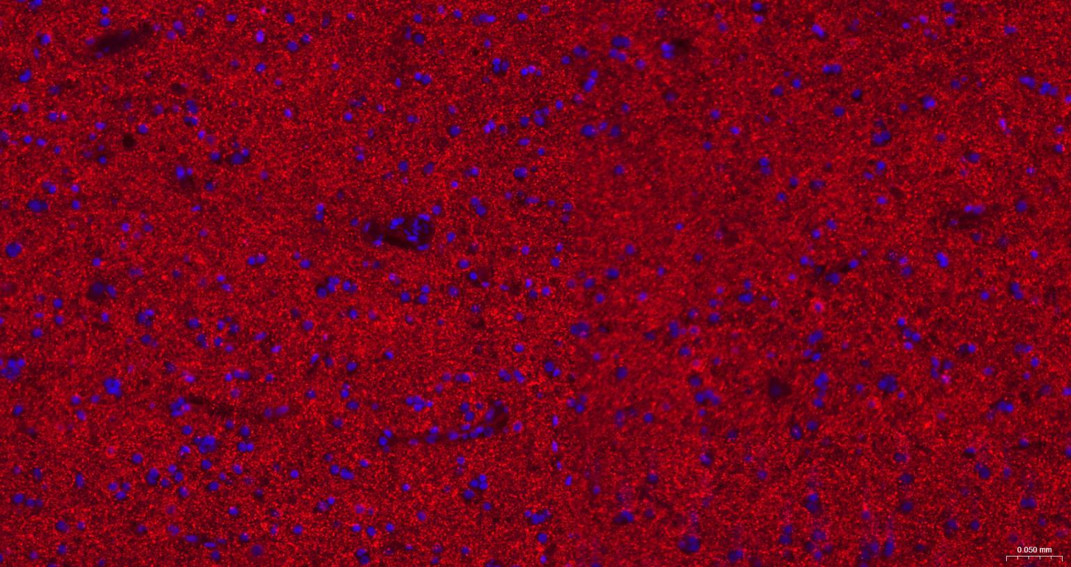 γ氨基丁酸运载蛋白1重组兔单抗