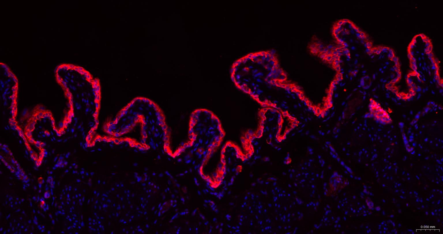 广谱细胞角蛋白PCK抗体